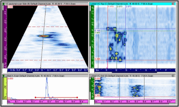 Example of a UT scan